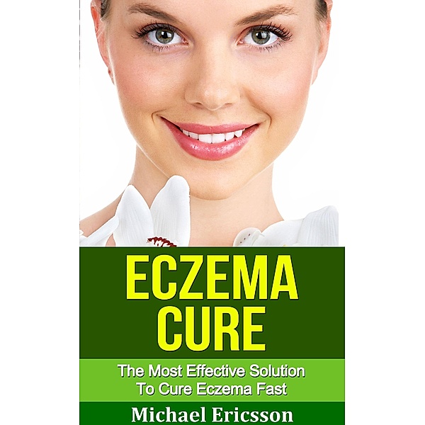 Eczema Cure: The Most Effective Solution to Cure Eczema Fast, Michael Ericsson