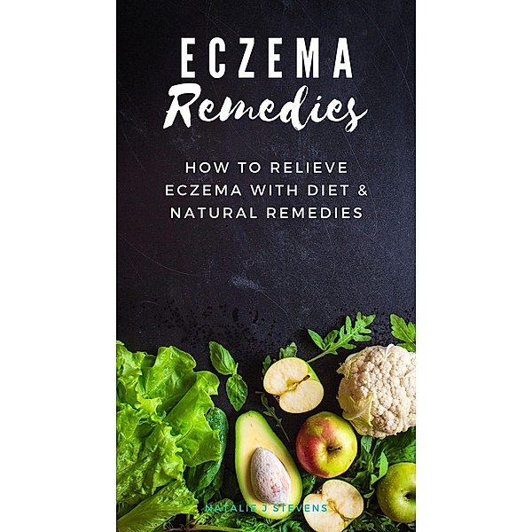 Eczema Remedies | How to Relieve Eczema With Diet & Natural Remedies, Natalie J. Stevens