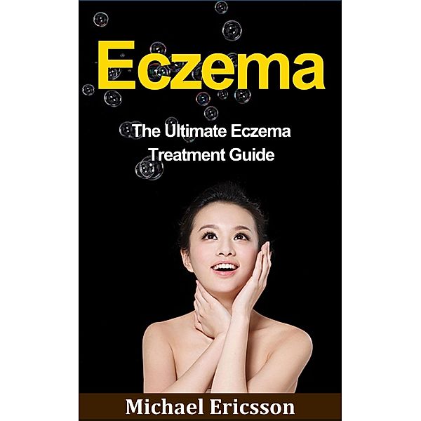 Eczema: The Ultimate Eczema Treatment Guide, Michael Ericsson