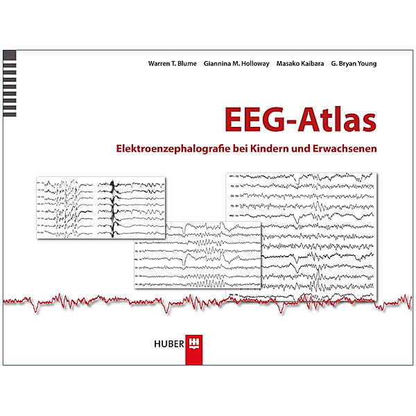 EEG-Atlas, Warren T. Blume, Giannina M. Holloway, Masako Kaibara, G. Bryan Young