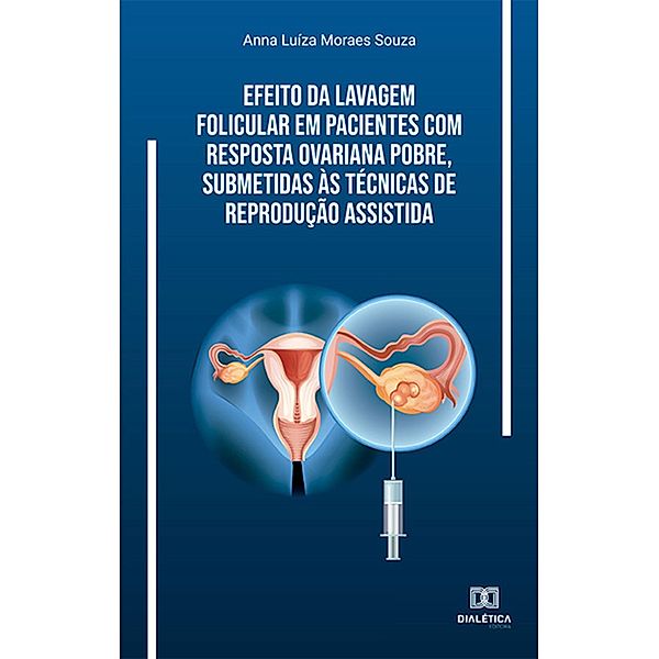 Efeito da lavagem folicular em pacientes com resposta ovariana pobre, submetidas às técnicas de reprodução assistida, Anna Luíza Moraes Souza