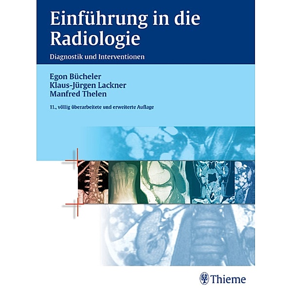 Einführung in die Radiologie, Egon Bücheler, Klaus-Jürgen Lackner, Manfred Thelen