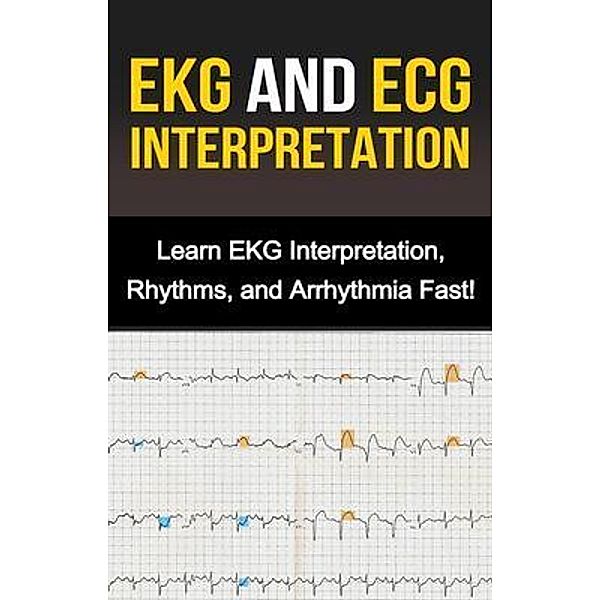 EKG and ECG Interpretation / Ingram Publishing, Alyssa Stone
