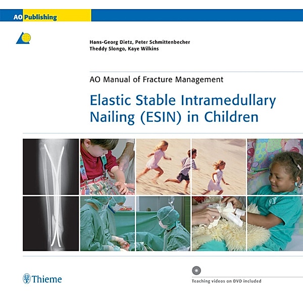 Elastic Stable Intramedullary Nailing (ESIN) in Children / AO-Publishing, Hans-Georg Dietz, Peter P Schmittenbecher, Theddy Slongo, Kaye E. Wilkins