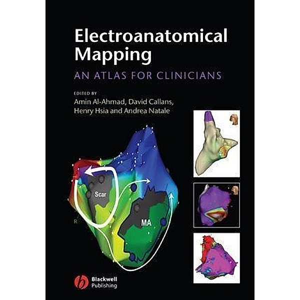 Electroanatomical Mapping