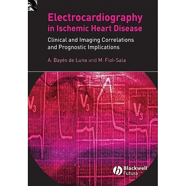 Electrocardiography in Ischemic Heart Disease, Antoni Bayés de Luna, Miquel Fiol-Sala