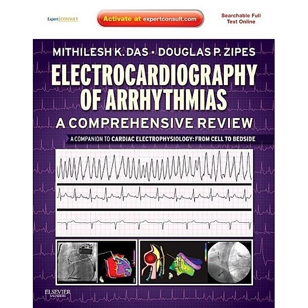 Electrocardiography of Arrhythmias: A Comprehensive Review, Mithilesh Kumar Das, Douglas P. Zipes