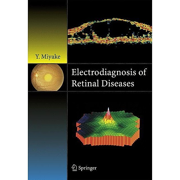 Electrodiagnosis of Retinal Disease, Yozo Miyake
