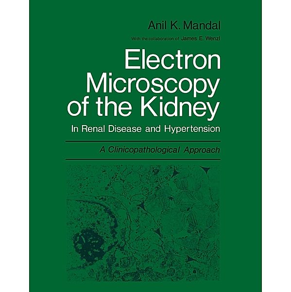 Electron Microscopy of the Kidney, Anil K. Mandal