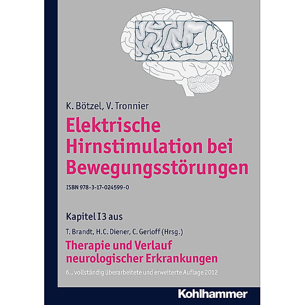 Elektrische Hirnstimulation bei Bewegungsstörungen, V. Tronnier, K. Bötzel