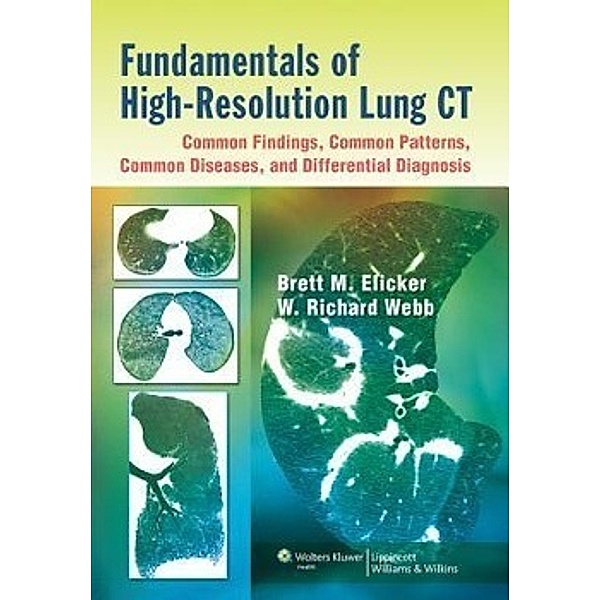 Elicker, B: Fundamentals of High-resolution Lung CT, Brett M. Elicker, W. Richard Webb