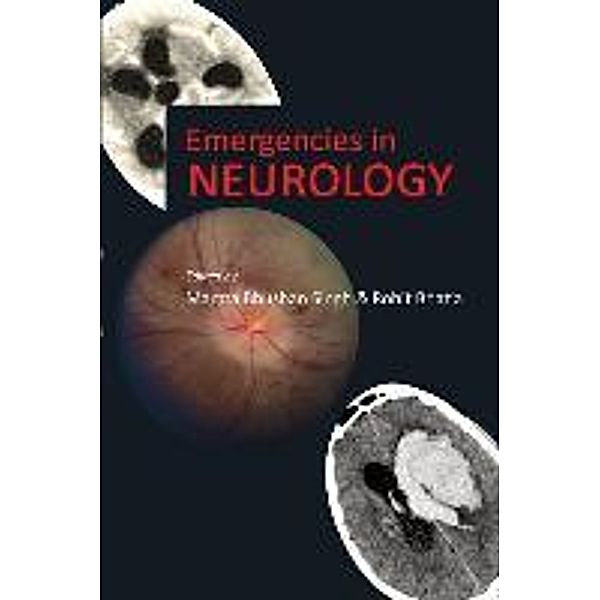 Emergencies in Neurology, Mamta Bhushan Singh, Rohit Bhatia