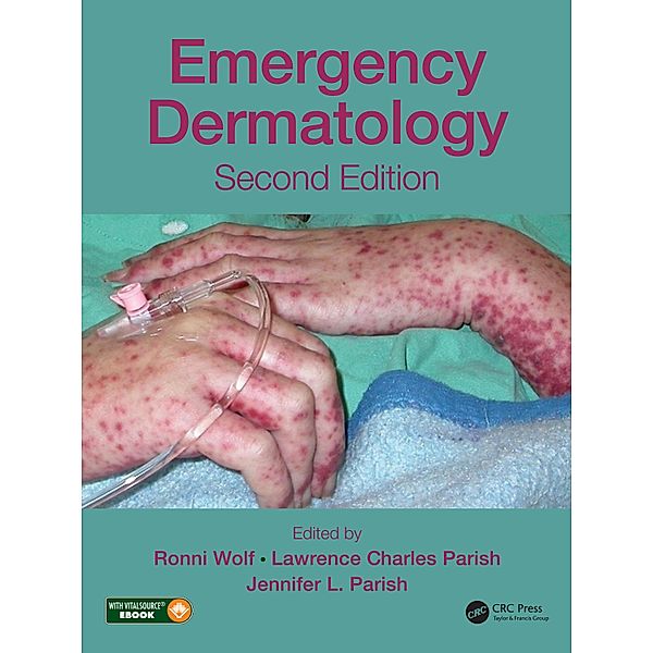 Emergency Dermatology