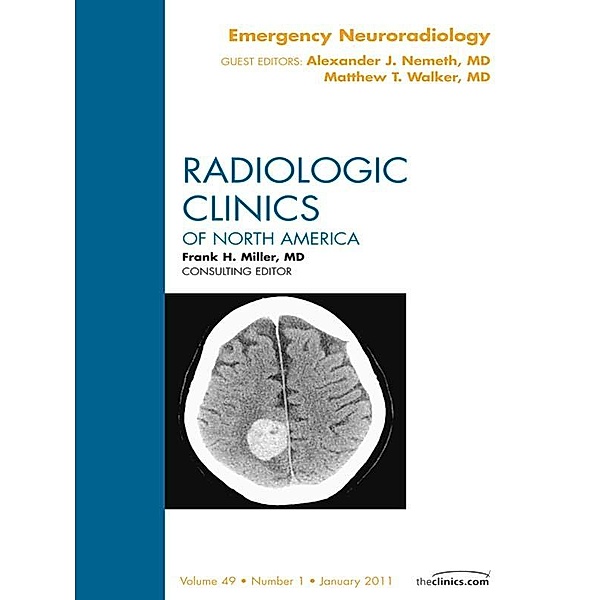 Emergency Neuroradiology, An Issue of Radiologic Clinics of North America, Matthew T. Walker, Alexander Nemeth
