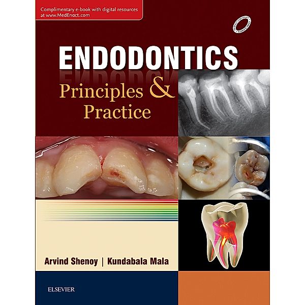 Endodontics: Principles and Practice E-book, Arvind Shenoy, Kundabala Mala