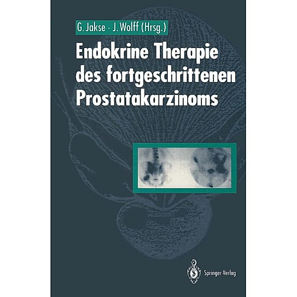 Endokrine Therapie des fortgeschrittenen Prostatakarzinoms