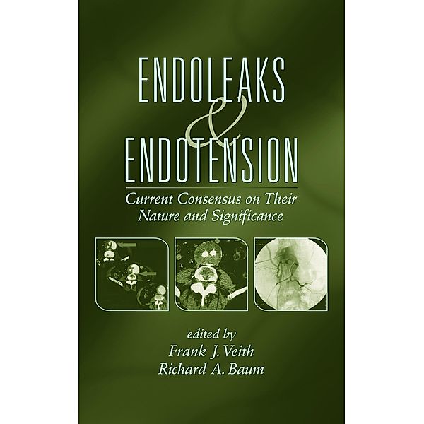 Endoleaks and Endotension