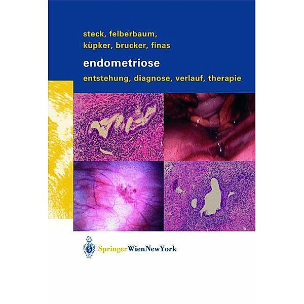 Endometriose, Thomas Steck, Ricardo E. Felberbaum, Dominique F. Finas, Cosima Brucker, Wolfgang Küpker