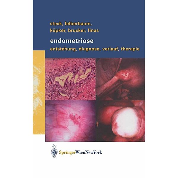 Endometriose, Thomas Steck, Ricardo E. Felberbaum, Wolfgang Küpker, Cosima Brucker, Dominique F. Finas