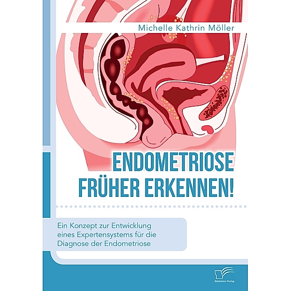 Endometriose früher erkennen! Ein Konzept zur Entwicklung eines Expertensystems für die Diagnose der Endometriose, Michelle Kathrin Möller