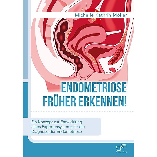 Endometriose früher erkennen! Ein Konzept zur Entwicklung eines Expertensystems für die Diagnose der Endometriose, Michelle Kathrin Möller