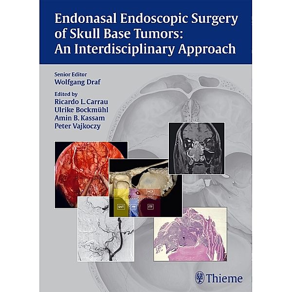 Endonasal Endoscopic Surgery of Skull Base Tumors, Wolfgang Draf, Ricardo L. Carrau, Ulrike Bockmühl, Amin B. Kassam, Peter Vajkoczy