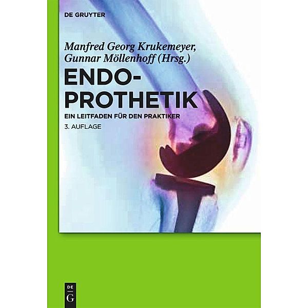 Endoprothetik