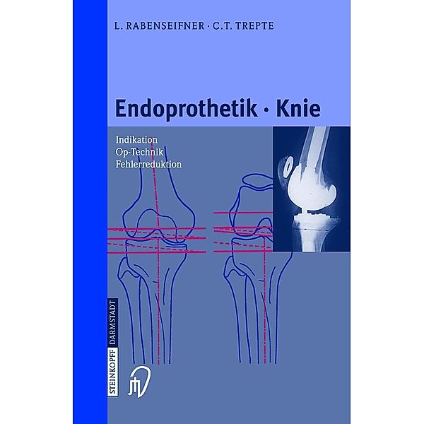 Endoprothetik Knie, L. Rabenseifner, C. Trepte