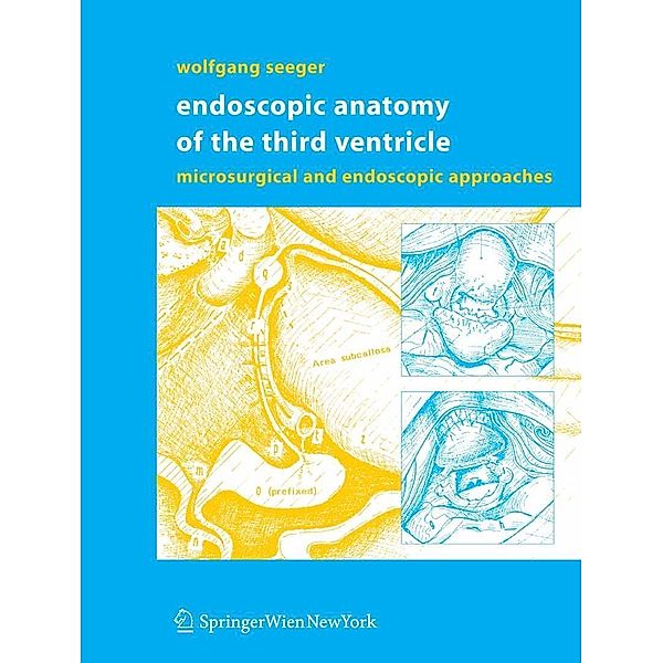 Endoscopic Anatomy of the Third Ventricle, Wolfgang Seeger