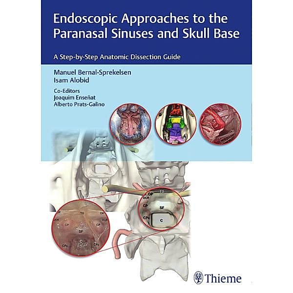 Endoscopic Approaches to the Paranasal Sinuses and Skull Base