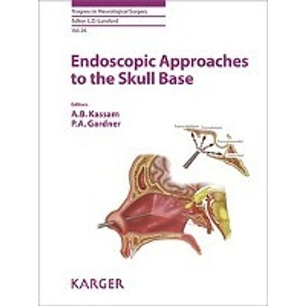 Endoscopic Approaches to the Skull Base