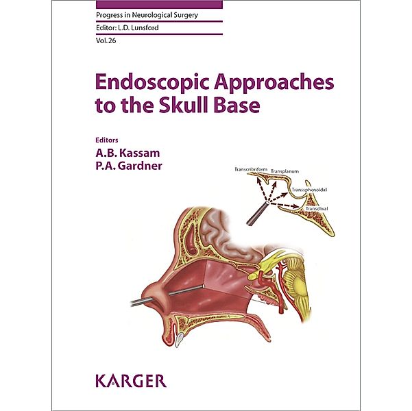 Endoscopic Approaches to the Skull Base