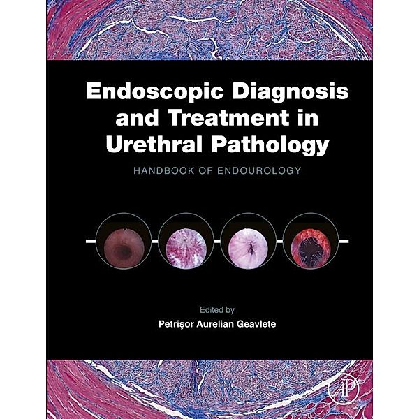 Endoscopic Diagnosis and Treatment in Urethral Pathology