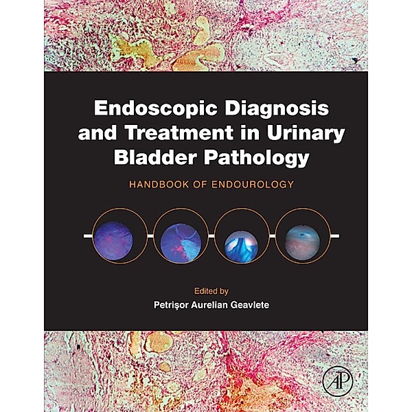 Endoscopic Diagnosis and Treatment in Urinary Bladder Pathology
