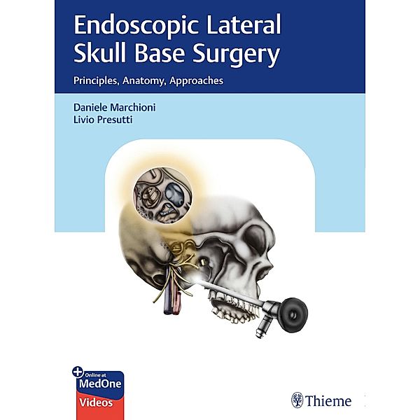 Endoscopic Lateral Skull Base Surgery