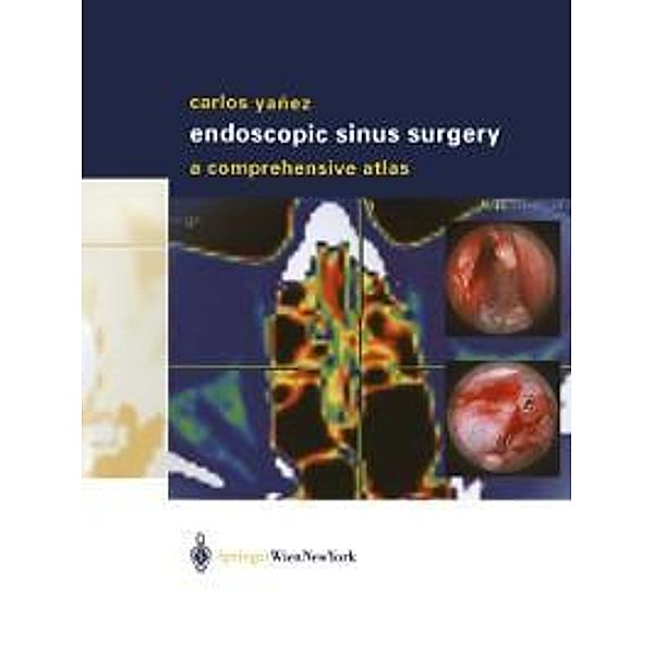 Endoscopic Sinus Surgery, Carlos Yañez