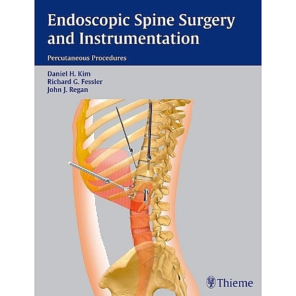 Endoscopic Spine Surgery and Instrumentation, Daniel H. Kim, Richard G. Fessler
