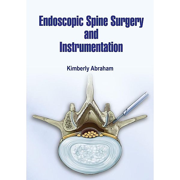 Endoscopic Spine Surgery and Instrumentation, Kimberly Abraham