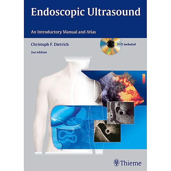 Endoscopic Ultrasound, w. DVD-ROM, Christoph Fr. Dietrich