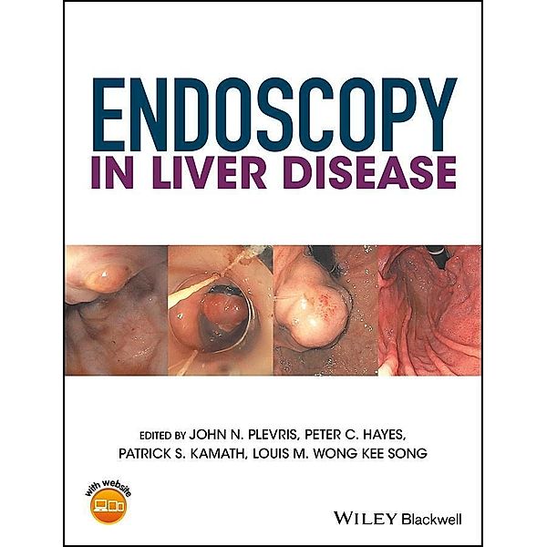 Endoscopy in Liver Disease