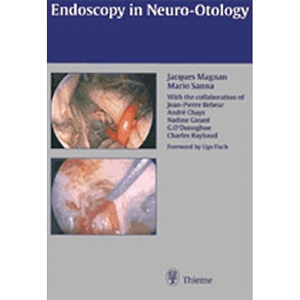 Endoscopy in Neuro-Otology, Jacques Magnan, Mario Sanna