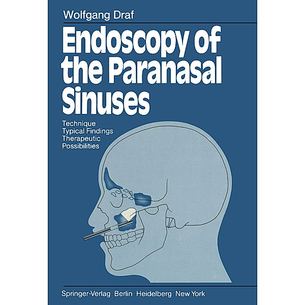 Endoscopy of the Paranasal Sinuses, Wolfgang Draf