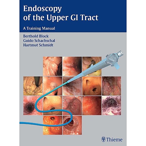 Endoscopy of the Upper GI Tract, Berthold Block, Guido Schachschal, Hartmut H. -J. Schmidt