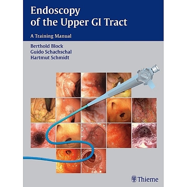 Endoscopy of the Upper GI Tract, Berthold Block, Guido Schachschal, Hartmut Schmidt