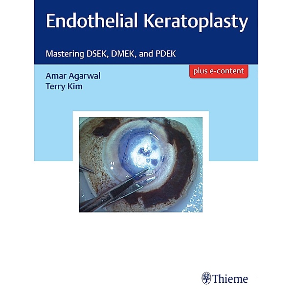 Endothelial Keratoplasty, Amar Agarwal, Terry Kim