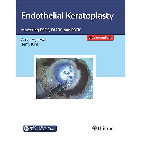 Endothelial Keratoplasty, Amar Agarwal, Terry Kim