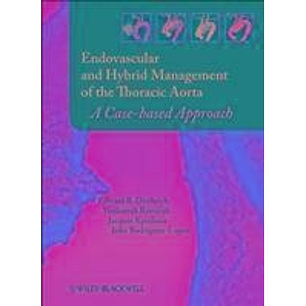 Endovascular and Hybrid Management of the Thoracic Aorta, Edward B. Diethrich, Venkatesh Ramaiah, Jacques Kpodonu, Julio A. Rodriguez-Lopez