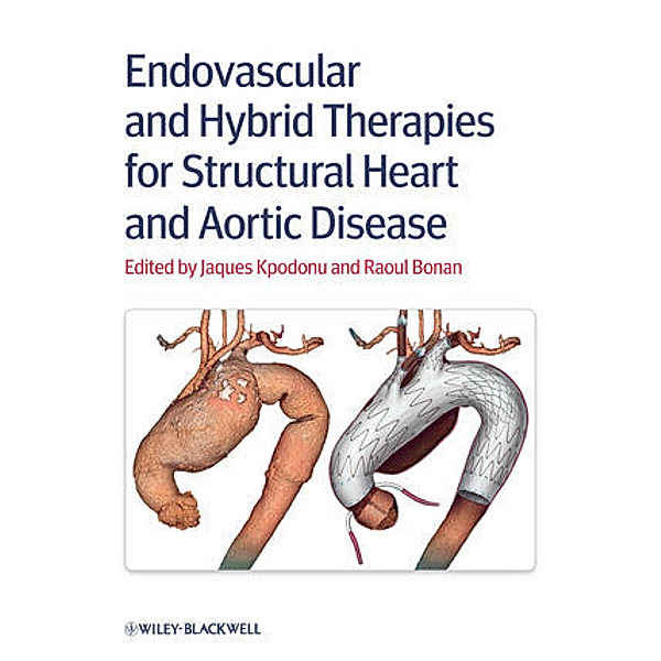 Endovascular and Hybrid Therapies for Structural Heart and Aortic Disease, Jacques Kpodonu