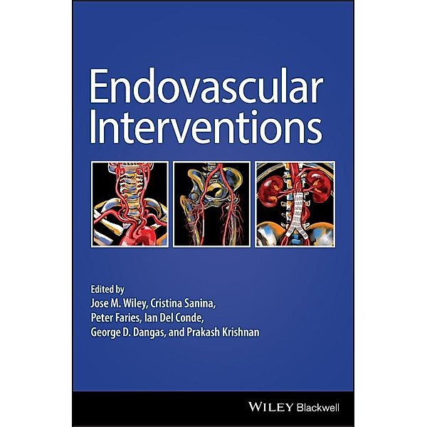 Endovascular Interventions