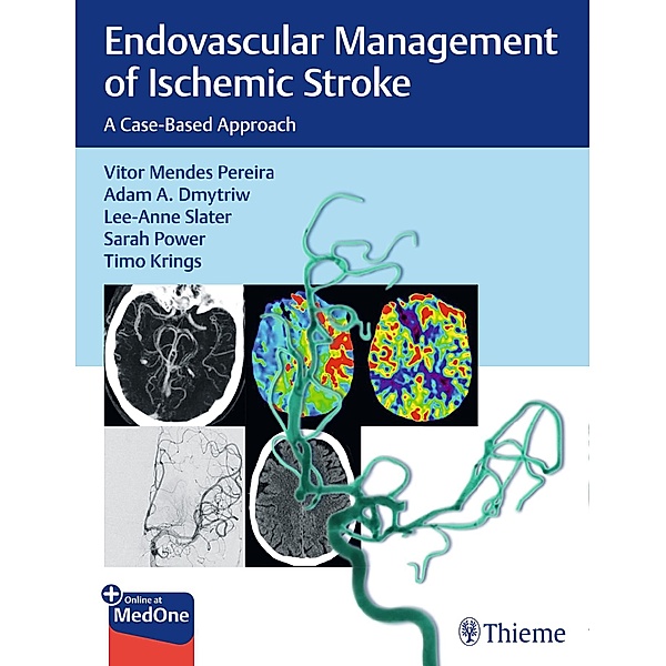Endovascular Management of Ischemic Stroke, Vitor Pereira, Adam Dmytriw, Lee-Anne Slater